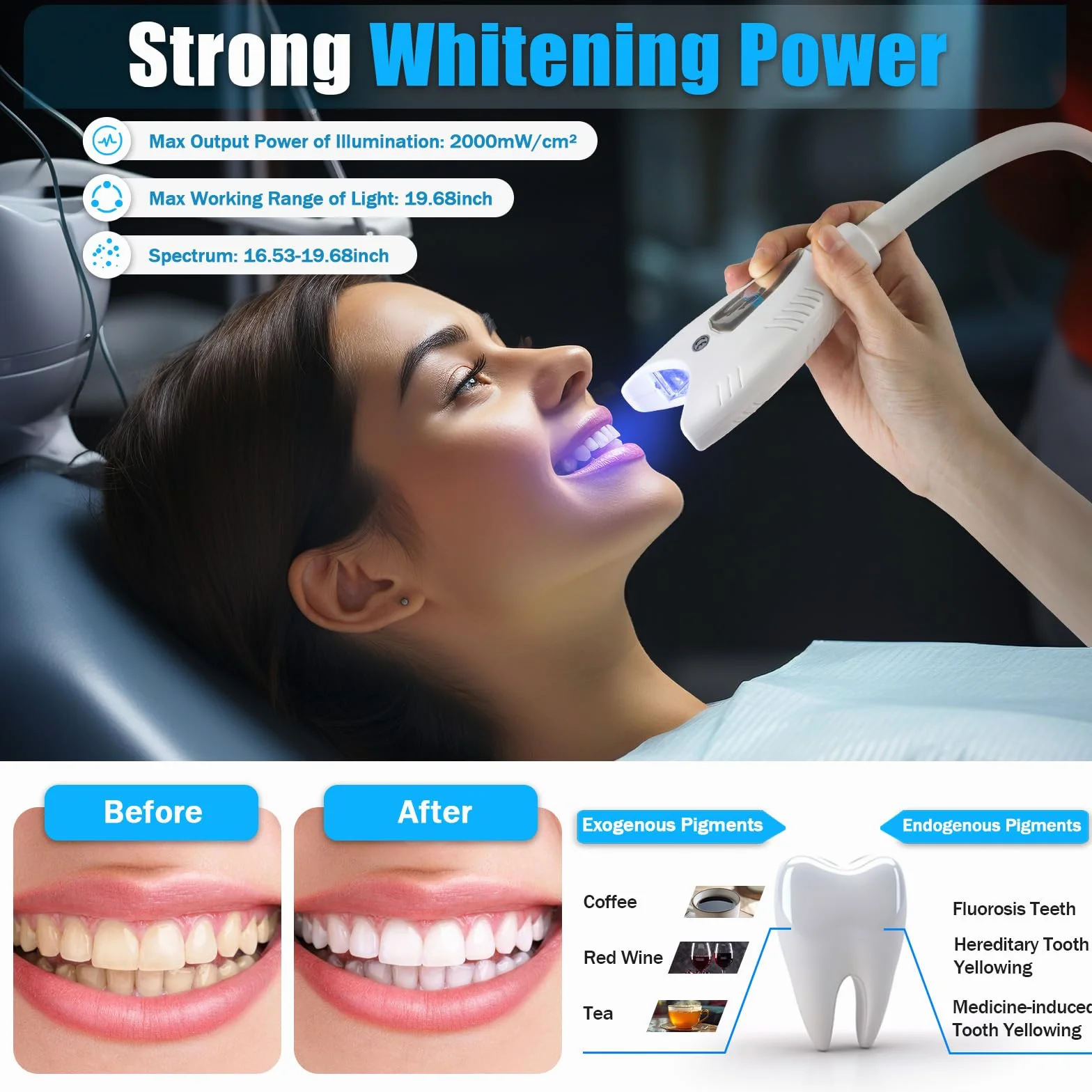 Zahnaufhellung instrument, Zahnbleaching Set Professionell, 4 LED Bleaching Zähne LED Zahnweiß Bleaching Lampe, mit 2 Paar Brillen, für Kliniken Krankenhäusern Schönheitssalons Haushalten